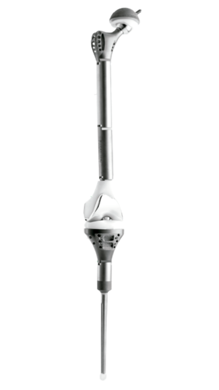 Endoprótesis Fémur Total